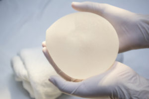 Breast Implant